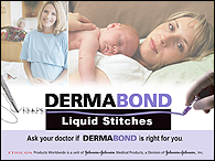 Dermabond Liquid Stitches